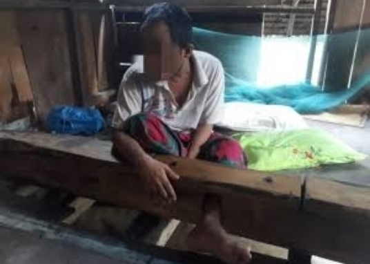 Aceh Targetkan Eliminasi Pasung bagi ODGJ Akhir 2025