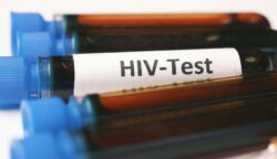 Kasus HIV/AIDS di Aceh Tembus 1.974, Anak Muda Kini Jadi Penyumbang Terbesar