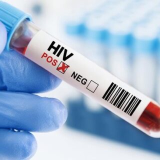 Kasus HIV/AIDS di Abdya Capai 17 Orang, Dinkes Perkuat Pencegahan dan Pengobatan Rutin