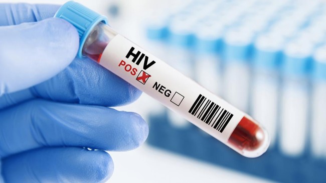 Kasus HIV/AIDS di Abdya Capai 17 Orang, Dinkes Perkuat Pencegahan dan Pengobatan Rutin